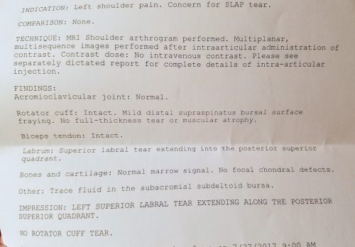 Radiology report from my mri arthrogram. Findings? Left superior labral tear extending along the posterior superior quadrant.